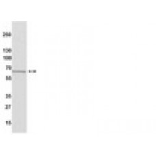 ODUTO IMUNOLOGICO ANTI-ESTROGENO RECEP A HUM CLONE 60C IGG COE IP/WB TEMPERATURA TRANSPORTE/ARMAZENAMENTO -20C 100UL (UND) MILLIPORE