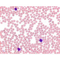 SOL. DE EOSINA-AZUL DE METILENO SEG. MAY-GRUNWALD (P/ MICROSCOPIA ) MERCK - FR. 2,5L