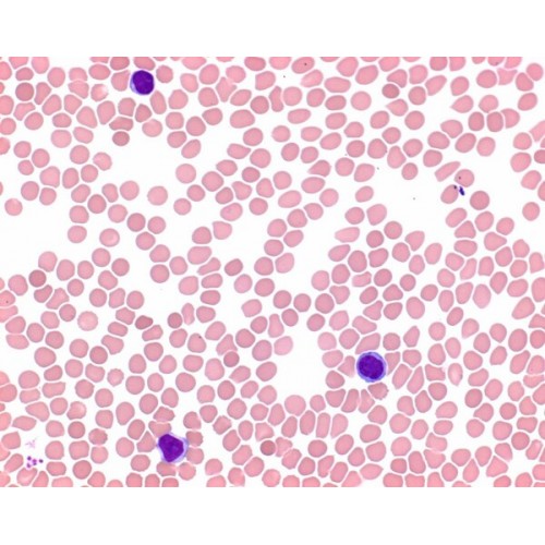 SOL. DE EOSINA-AZUL DE METILENO SEG. MAY-GRUNWALD (P/ MICROSCOPIA ) MERCK - FR. 2,5L SOL. DE EOSINA-AZUL DE METILENO SEG. MAY-GRUNWALD (P/ MICROSCOPIA ) MERCK - FR. 2,5L
