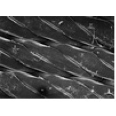 FILTRO TELA DE POLIPROPILENO DIAM. 47mm PORO 25um (CX) MILLIPORE